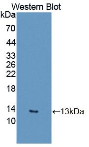 Polyclonal Antibody to Resistin (RETN)