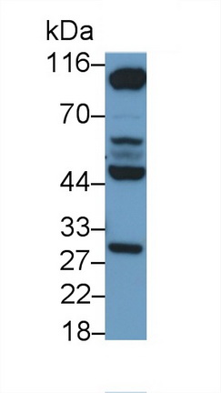 Polyclonal Antibody to Glycogen Phosphorylase, Liver (PYGL)