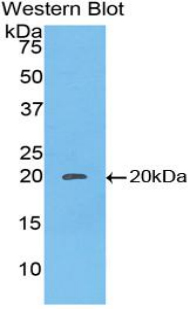 Polyclonal Antibody to Caspase 8 (CASP8)