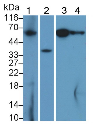 Polyclonal Antibody to Caspase 8 (CASP8)