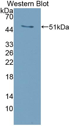 Polyclonal Antibody to Receptor Activator Of Nuclear Factor Kappa B Ligand (RANkL)