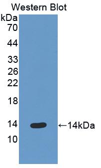 Polyclonal Antibody to Epithelial Neutrophil Activating Peptide 78 (ENA78)