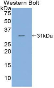 Polyclonal Antibody to Complement Component 2 (C2)