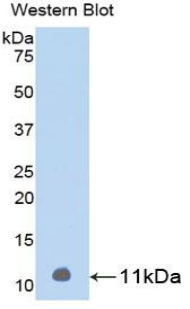 Polyclonal Antibody to Parathyroid Hormone (PTH)