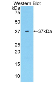 Polyclonal Antibody to Parathyroid Hormone (PTH)