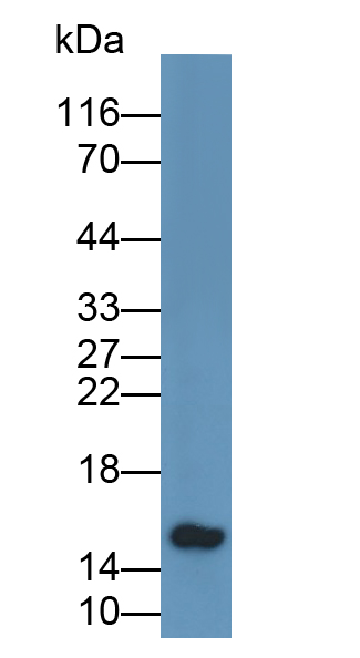 Polyclonal Antibody to Parathyroid Hormone (PTH)