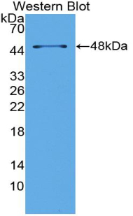 Polyclonal Antibody to Phospholipase A2 Group VII (LpPLA2)