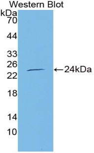 Polyclonal Antibody to Endothelial NOS (eNOS)