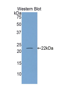 Polyclonal Antibody to Endothelial NOS (eNOS)