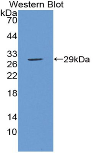 Polyclonal Antibody to Thyroid Hormone Receptor Beta (THRb)