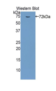 Polyclonal Antibody to Heat Shock Protein 70 (HSP70)