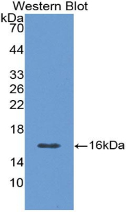 Polyclonal Antibody to Calcitonin Gene Related Peptide (CGRP)