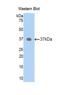 Polyclonal Antibody to Neuropeptide Y (NPY)