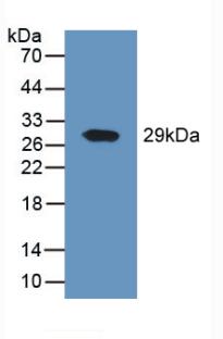 Polyclonal Antibody to Cluster Of Differentiation 26 (CD26)