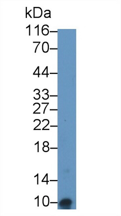 Polyclonal Antibody to Serum Amyloid A (SAA)