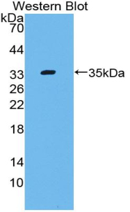 Polyclonal Antibody to Complement Component 4 (C4)