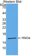 Polyclonal Antibody to Renin (REN)