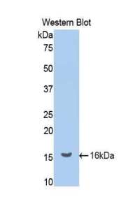 Polyclonal Antibody to Renin (REN)