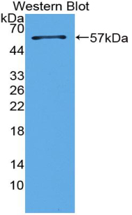 Polyclonal Antibody to Pulmonary Surfactant Associated Protein A1 (SFTPA1)