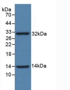 Polyclonal Antibody to Insulin Receptor (INSR)