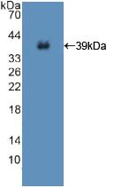 Polyclonal Antibody to Insulin Receptor (INSR)