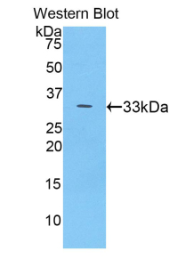 Polyclonal Antibody to Ceruloplasmin (CP)