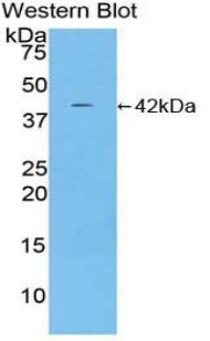 Polyclonal Antibody to Ceruloplasmin (CP)