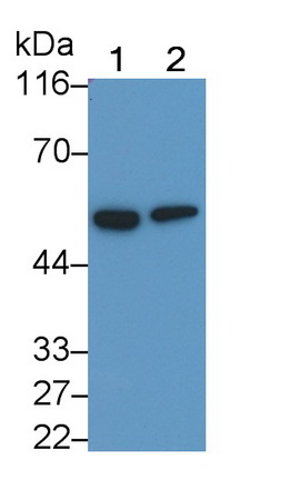 Polyclonal Antibody to Tumor Protein p53 (P53)