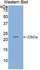 Polyclonal Antibody to Retinol Binding Protein 4 (RBP4)