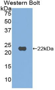 Polyclonal Antibody to Retinol Binding Protein 4 (RBP4)