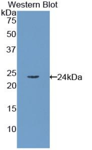 Polyclonal Antibody to Retinol Binding Protein 4 (RBP4)