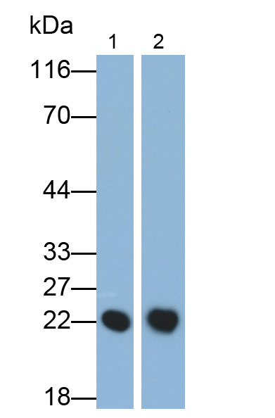 Polyclonal Antibody to Retinol Binding Protein 4 (RBP4)