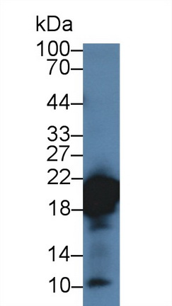 Polyclonal Antibody to Retinol Binding Protein 4 (RBP4)