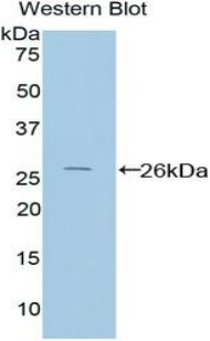 Polyclonal Antibody to Protein Interacting With C Kinase 1 (PICK1)