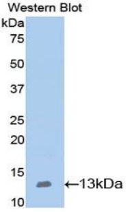 Polyclonal Antibody to Nephrin (NPHN)