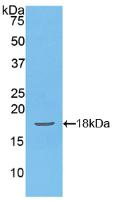 Polyclonal Antibody to Podocin (PDCN)