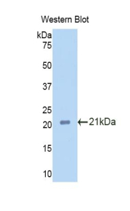 Polyclonal Antibody to Podocin (PDCN)