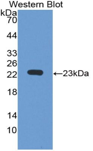 Polyclonal Antibody to Immunoglobulin Lambda Like Polypeptide 1 (IglL1)