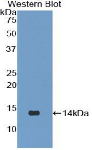 Polyclonal Antibody to Immunoglobulin Lambda Like Polypeptide 1 (IglL1)