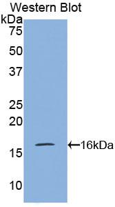 Polyclonal Antibody to Pre-B-Lymphocyte Gene 1 (VPREB1)