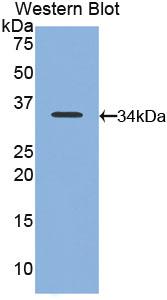 Polyclonal Antibody to Neutrophil Specific Antigen 1 (NB1)