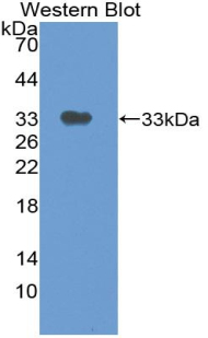 Polyclonal Antibody to Thymidine Phosphorylase (TP)