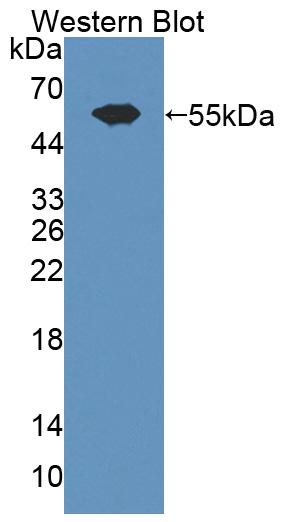 Polyclonal Antibody to Von Willebrand Factor Cleaving Protease (vWFCP)