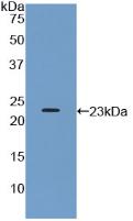 Polyclonal Antibody to Protein Tyrosine Phosphatase Receptor Type N (PTPRN)