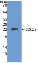 Polyclonal Antibody to Protein Tyrosine Phosphatase Receptor Type N (PTPRN)