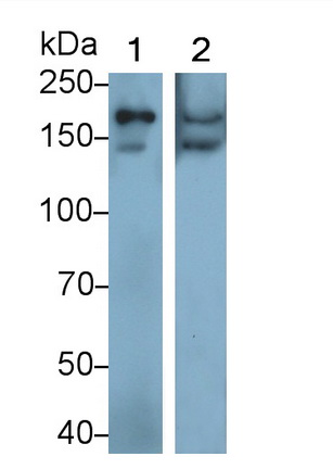 Polyclonal Antibody to Procollagen I N-Terminal Propeptide (PINP)