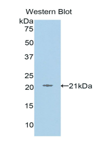 Polyclonal Antibody to L1-Cell Adhesion Molecule (L1CAM)