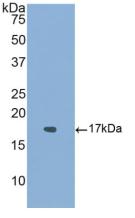 Polyclonal Antibody to Activin A Receptor Type I (ACVR1)
