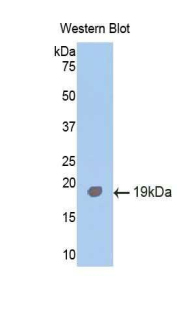 Polyclonal Antibody to Activin A Receptor Type I (ACVR1)