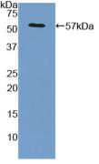 Polyclonal Antibody to Glypican 3 (GPC3)